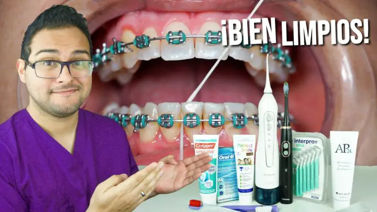 Como Lavarse Los Dientes Con Los Brackets | Actualizado Octubre 2024